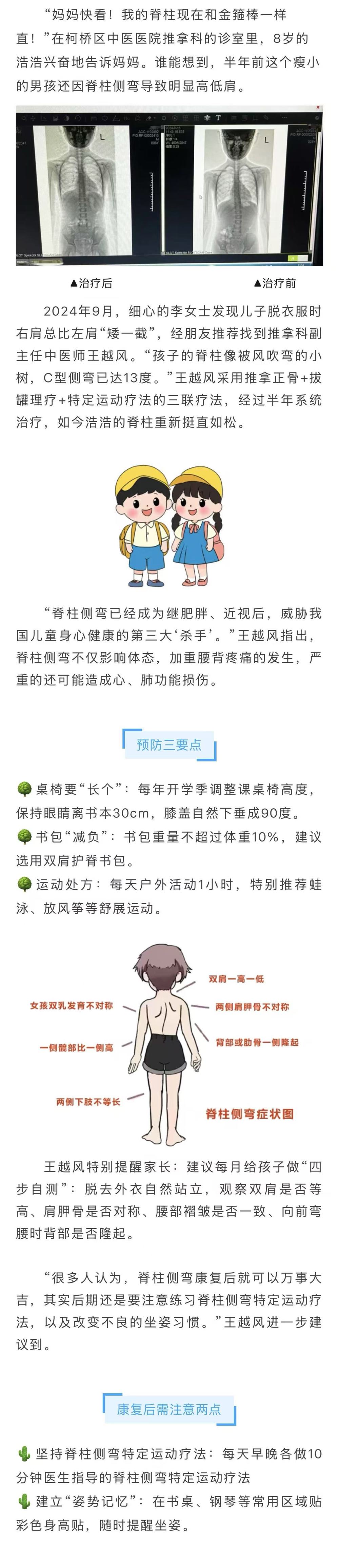 脊柱侧弯