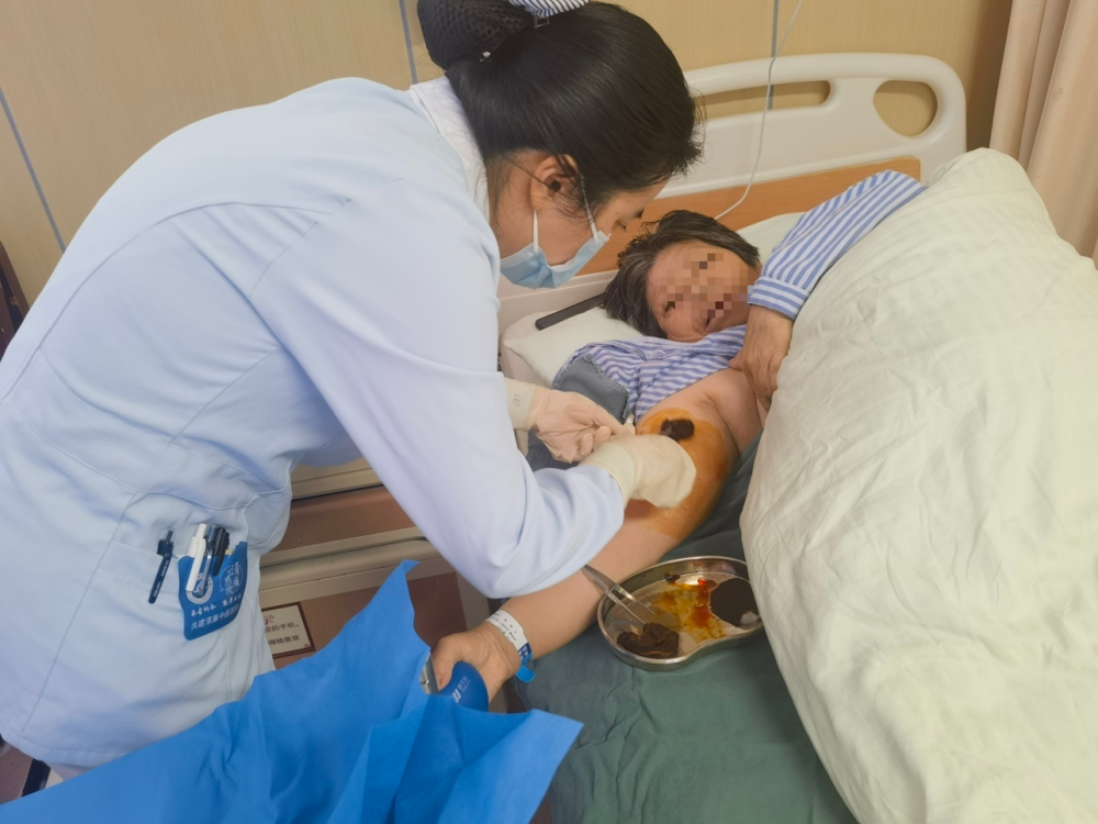 △10月6日上午,住院部14楼护士王莉为患者进行PICC导管维护 △10月6日上午,住院部14楼护士王莉为患者进行PICC导管维护